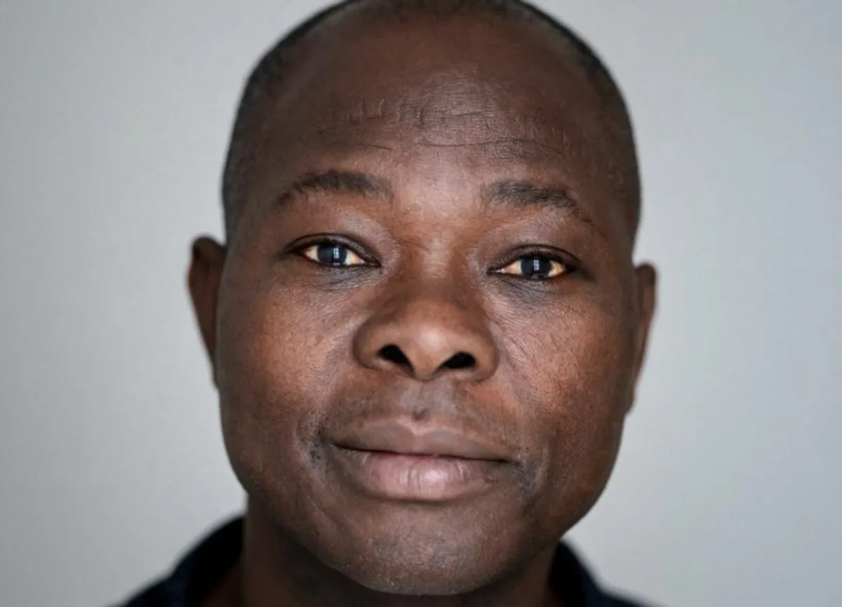 Plano fechado do arquiteto Diébédo Francis Kéré, um homem negro, careca, com olhos amendoados, nariz de base larga e lábios volumosos.